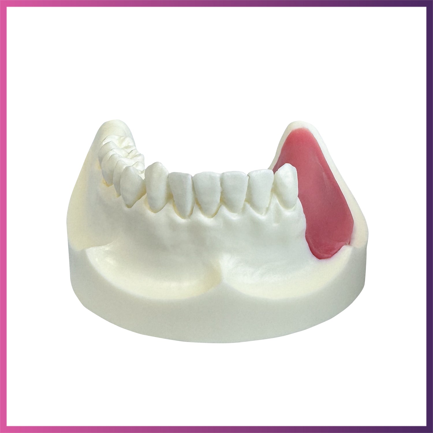 Implant Model (Lower & Upper Jaw)