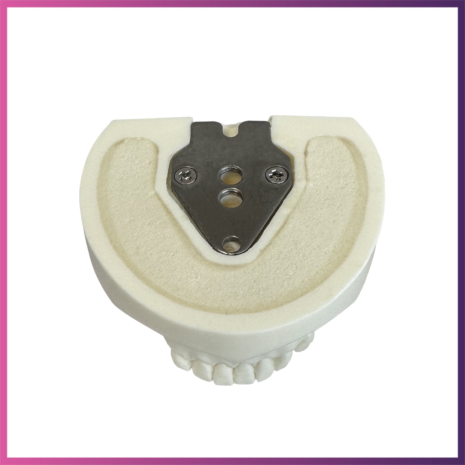 Implant Model (Lower & Upper Jaw)