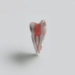 Modèle de dents en résine 3D avec canal radiculaire