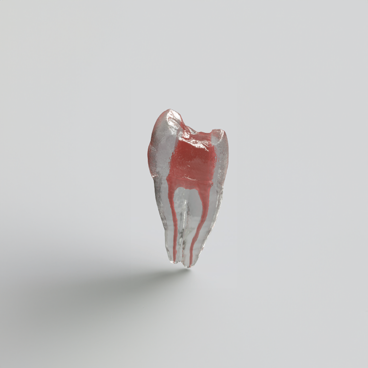 Modelo de dientes de resina en 3D para conducto radicular