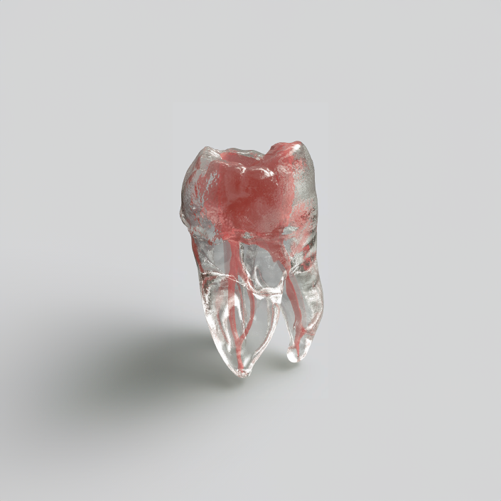 Modelo de dientes de resina en 3D para conducto radicular