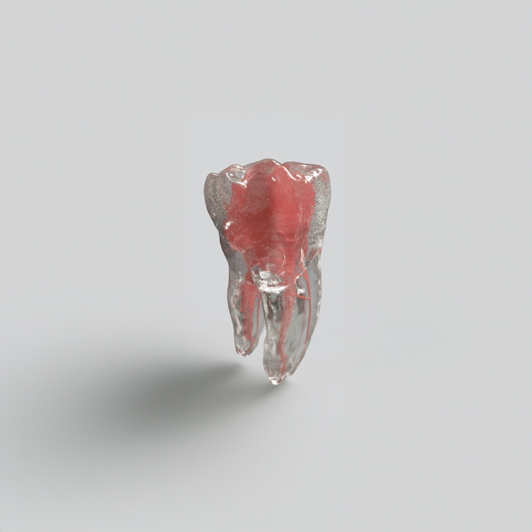 Modèle de dents en résine 3D avec canal radiculaire