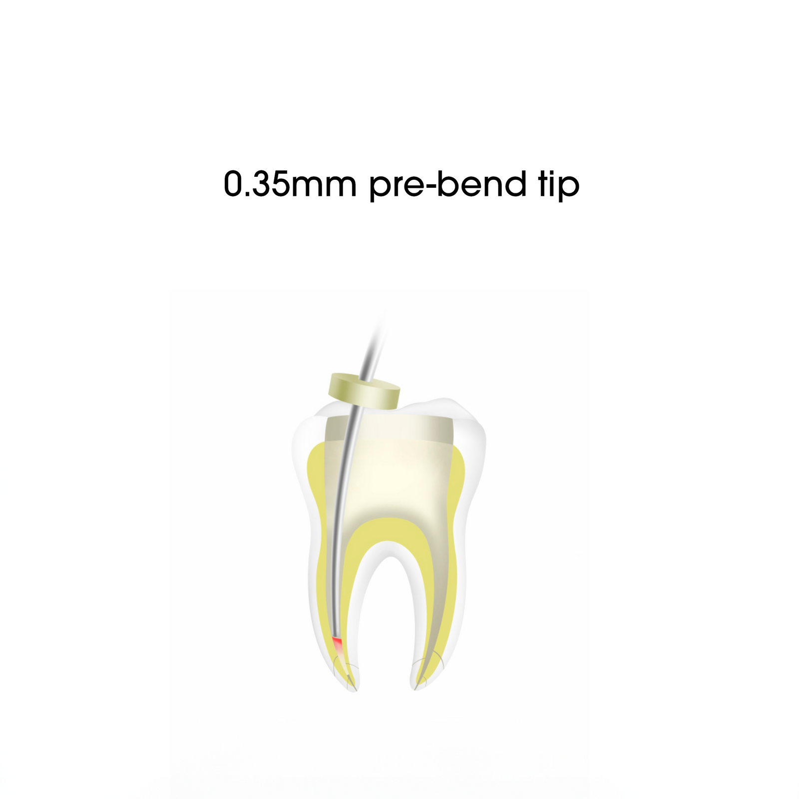 WP6012 for Fi-P (Tip Size 0.60mm, Taper: 0.12)