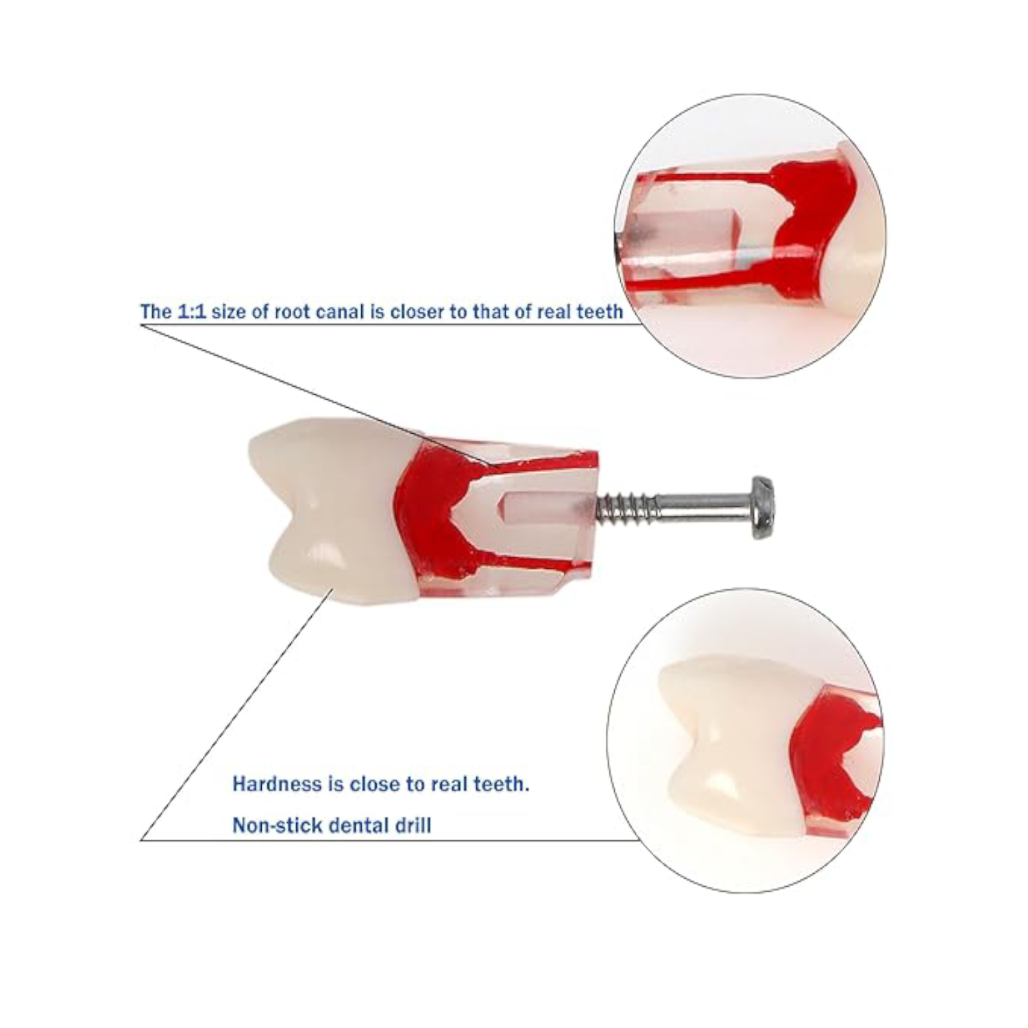 Kilgore Nissin Dental 200 Type 28 Dents RCT (Modèle de dents typodontes pour la pratique du traitement du canal radiculaire endoscopique)