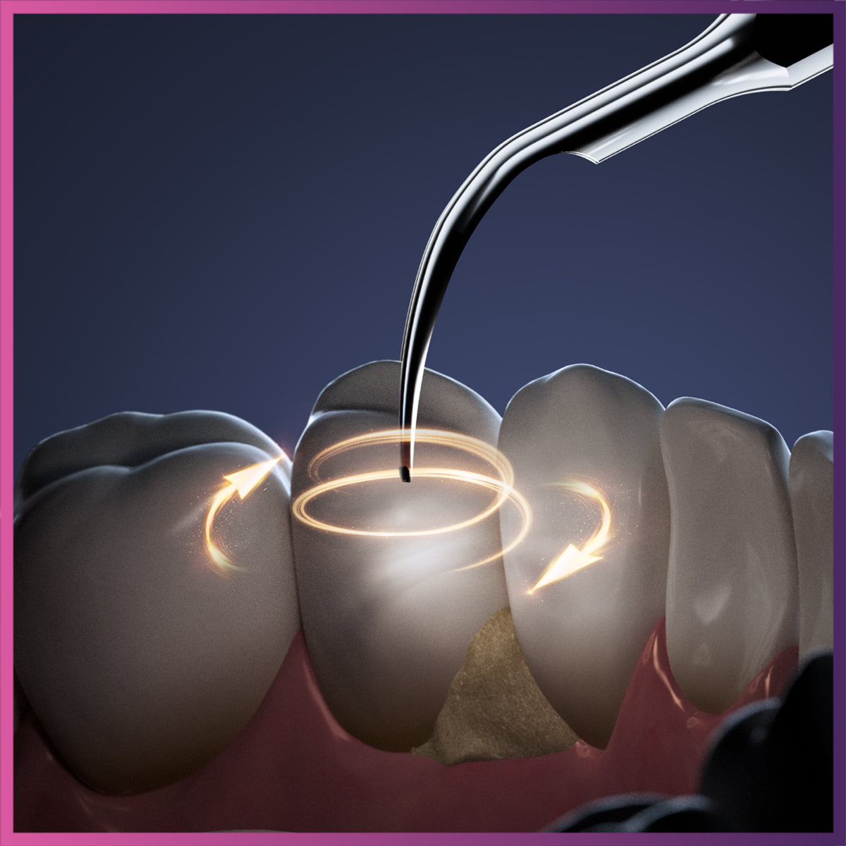 DTE D6-LED Ultrasonic Scaler