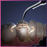 DTE D6-LED Ultrasonic Scaler