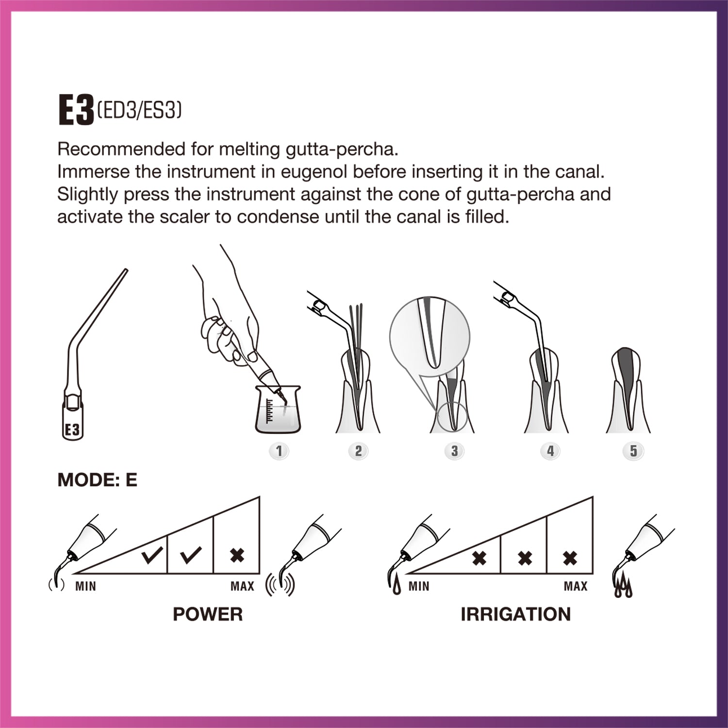 Punta periodontal Woodpecker/DTE - PD1 (paquete de 5)