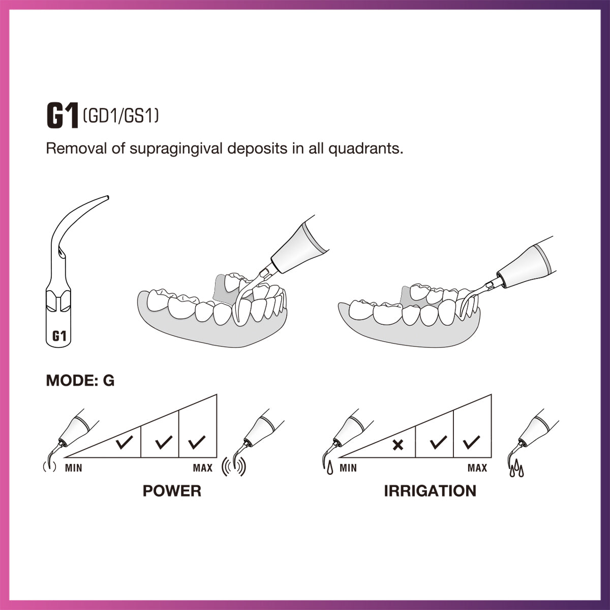 Woodpecker / Ultrasonic Scaler Tip - G1