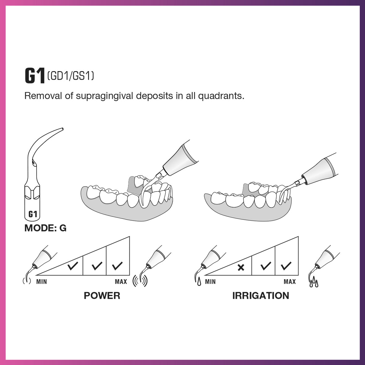 DTE Scaling Tip - GD1 (5 per pack)