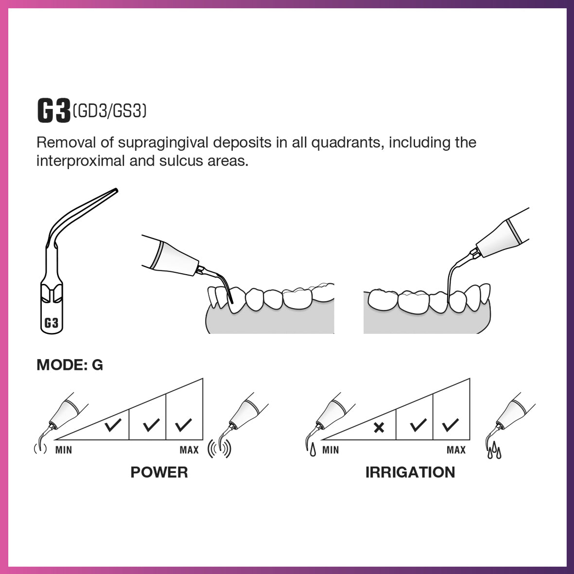 Embout de détartreur GD3 (5 par paquet)