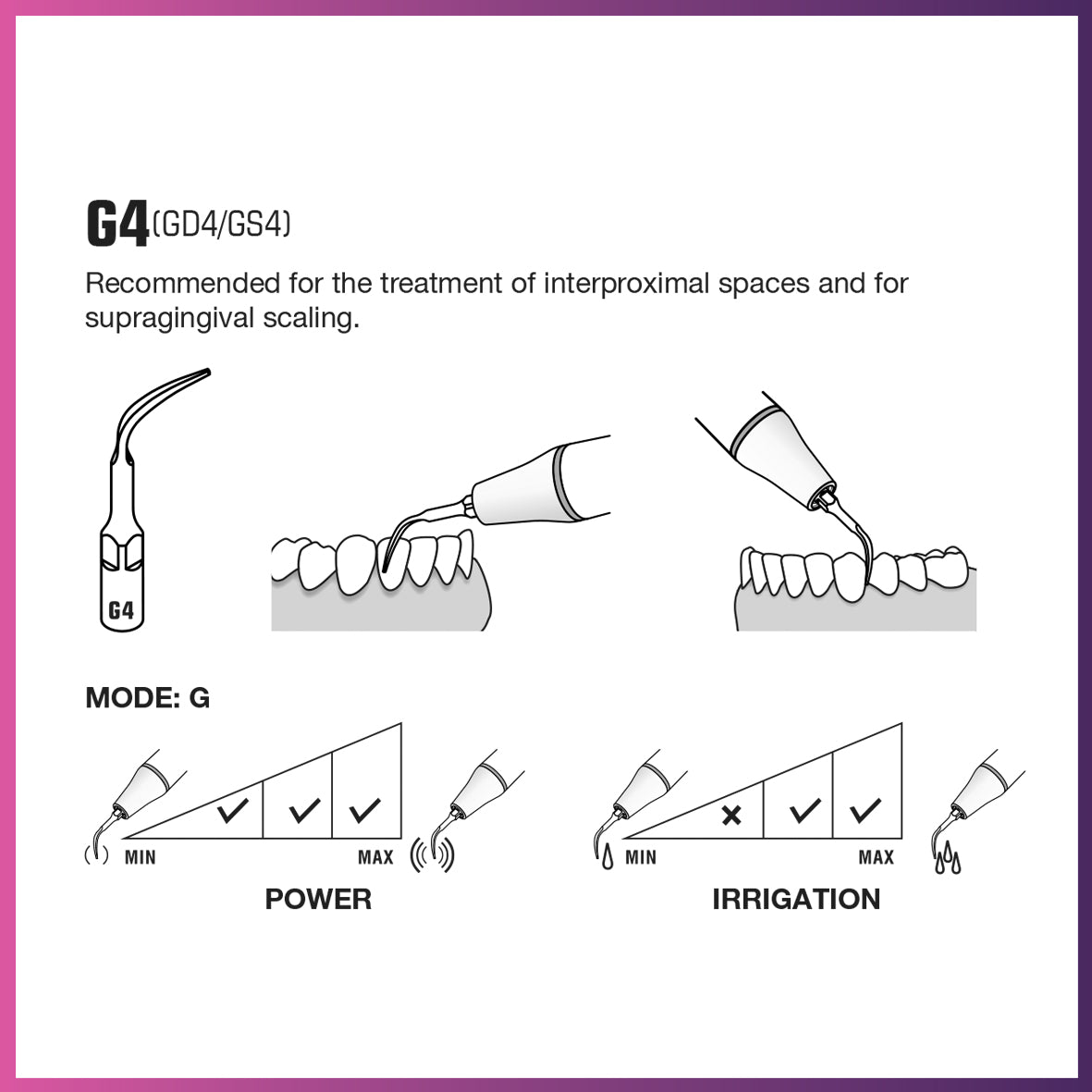 Puntas plateadas para raspador ultrasónico GD4 (5 por paquete)