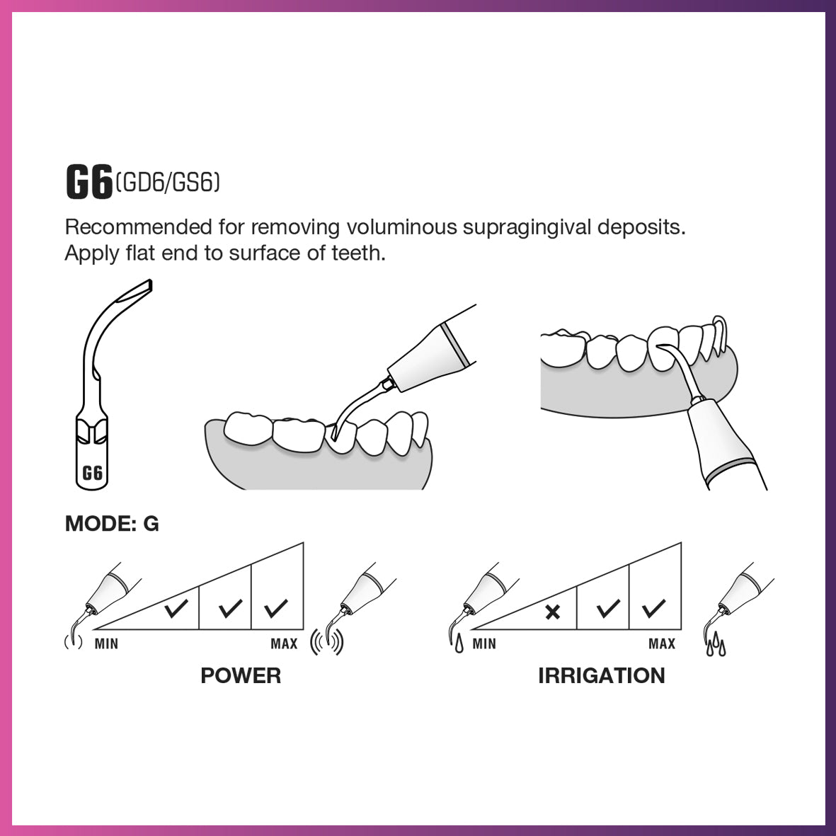 DTE Scaling Tip - GD6 (5 per pack)