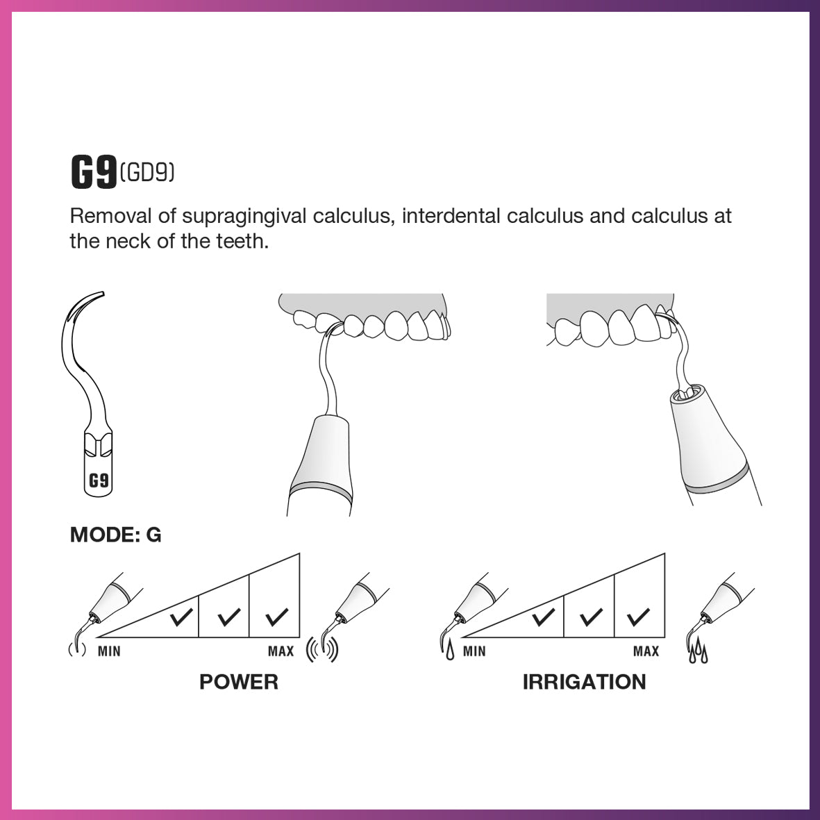 DTE Scaling Tip - GD9