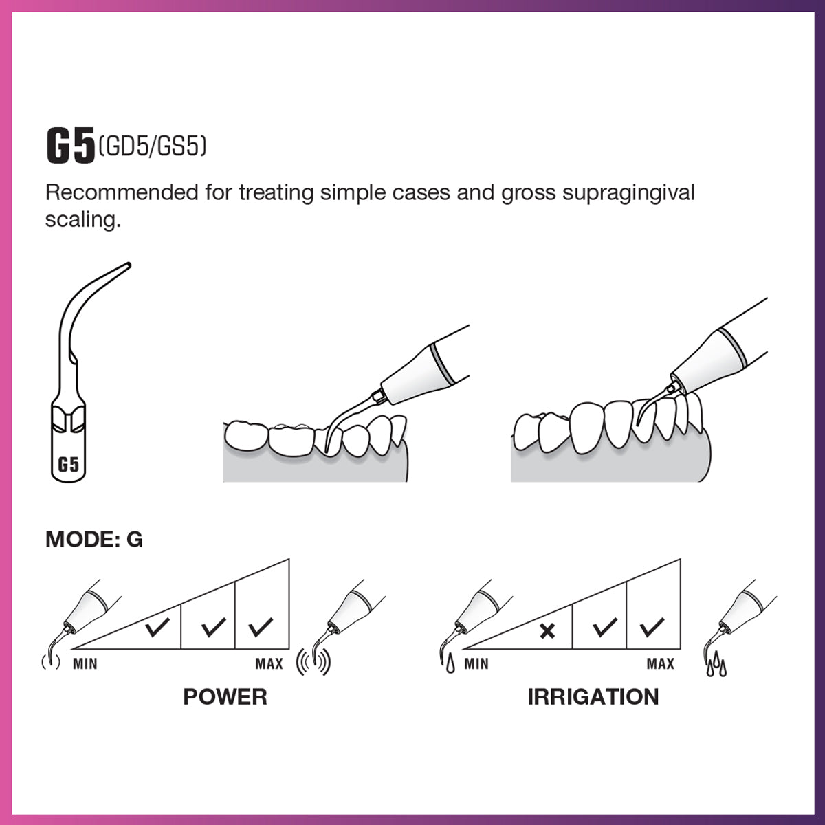 DTE Scaling Tip - GD5