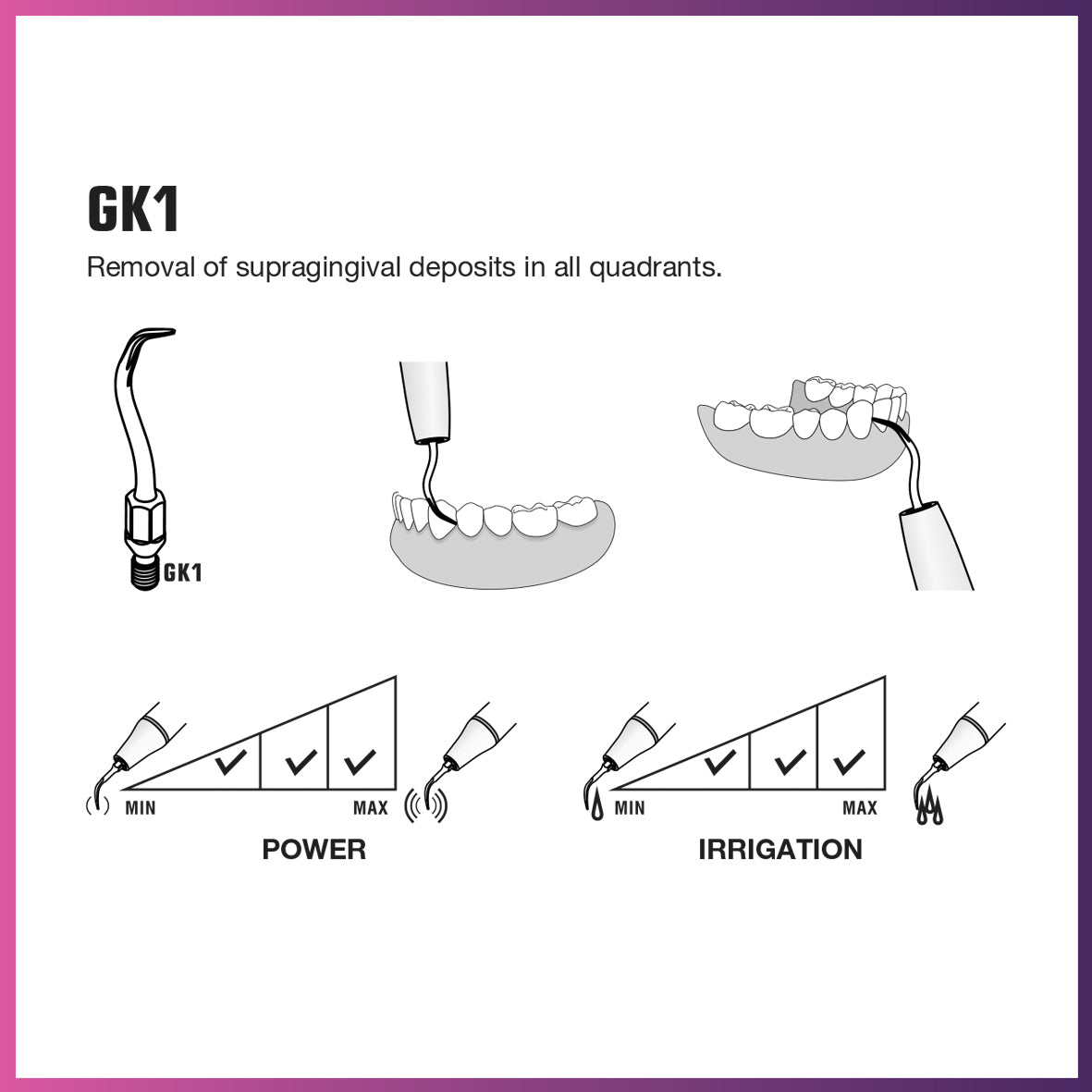 Embout de détartrage - GK1 (pack de 5)