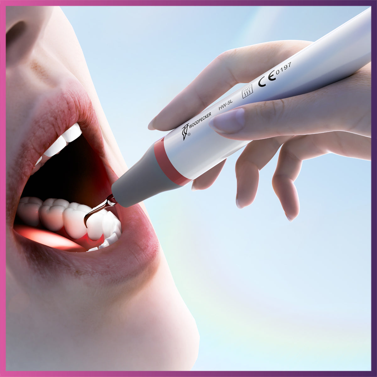 Woodpecker HW-5L Extra Handpiece for Ultrasonic Scaler