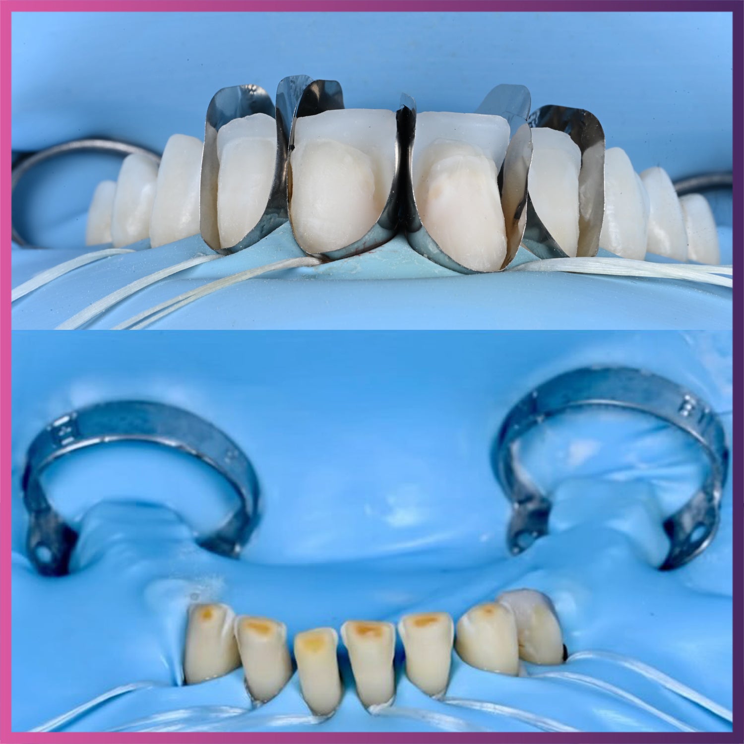 ISODAM Powder Free Non-Latex Polyisoprene Dental Dam