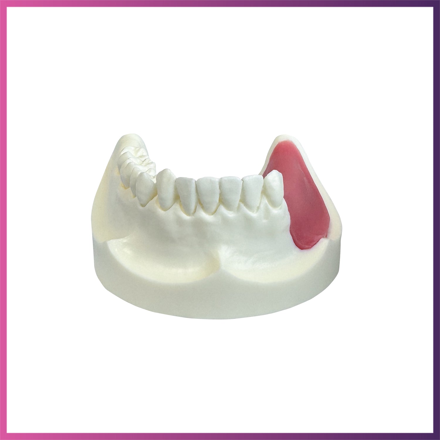 Implant Model (Lower & Upper Jaw)