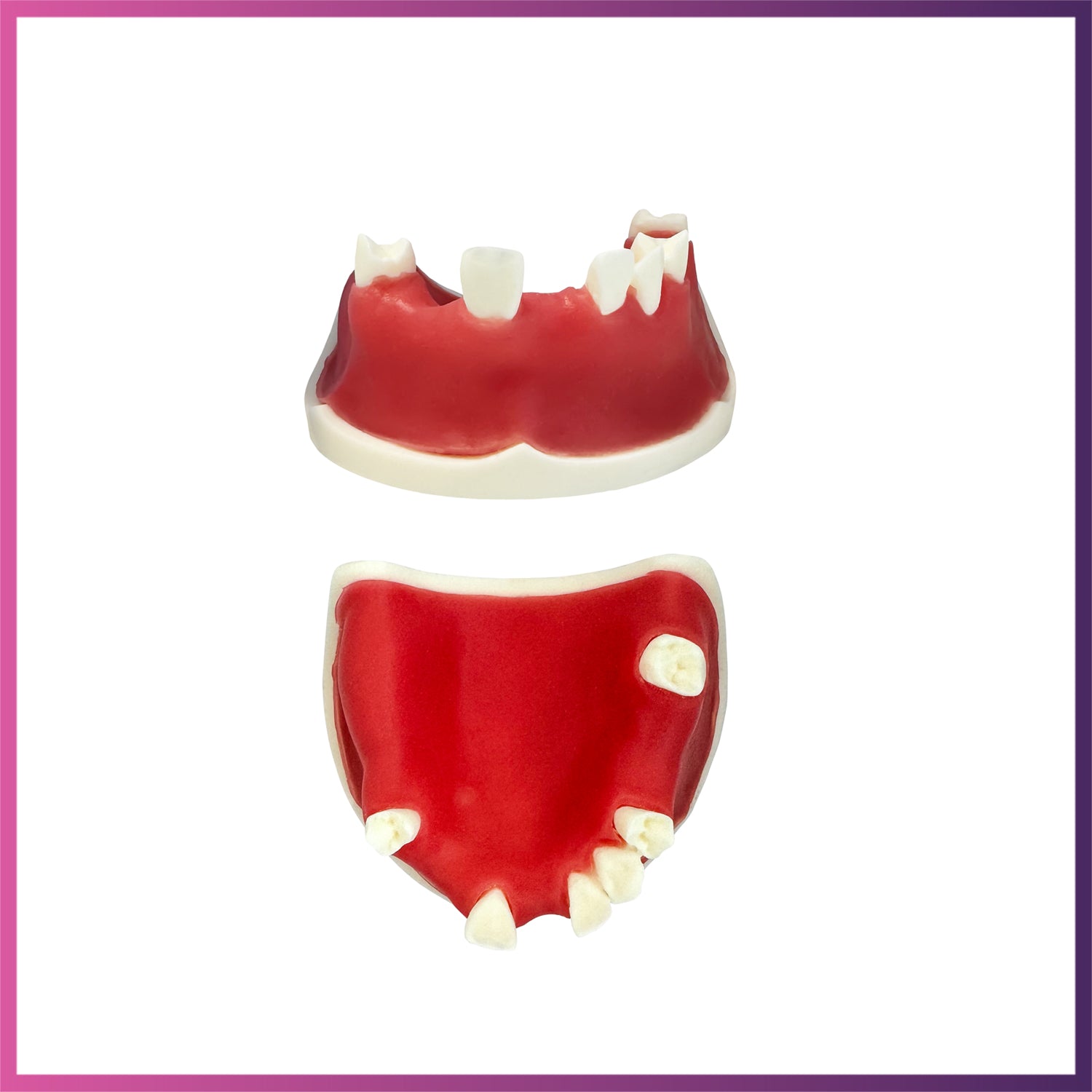 Implant Model (Lower & Upper Jaw)
