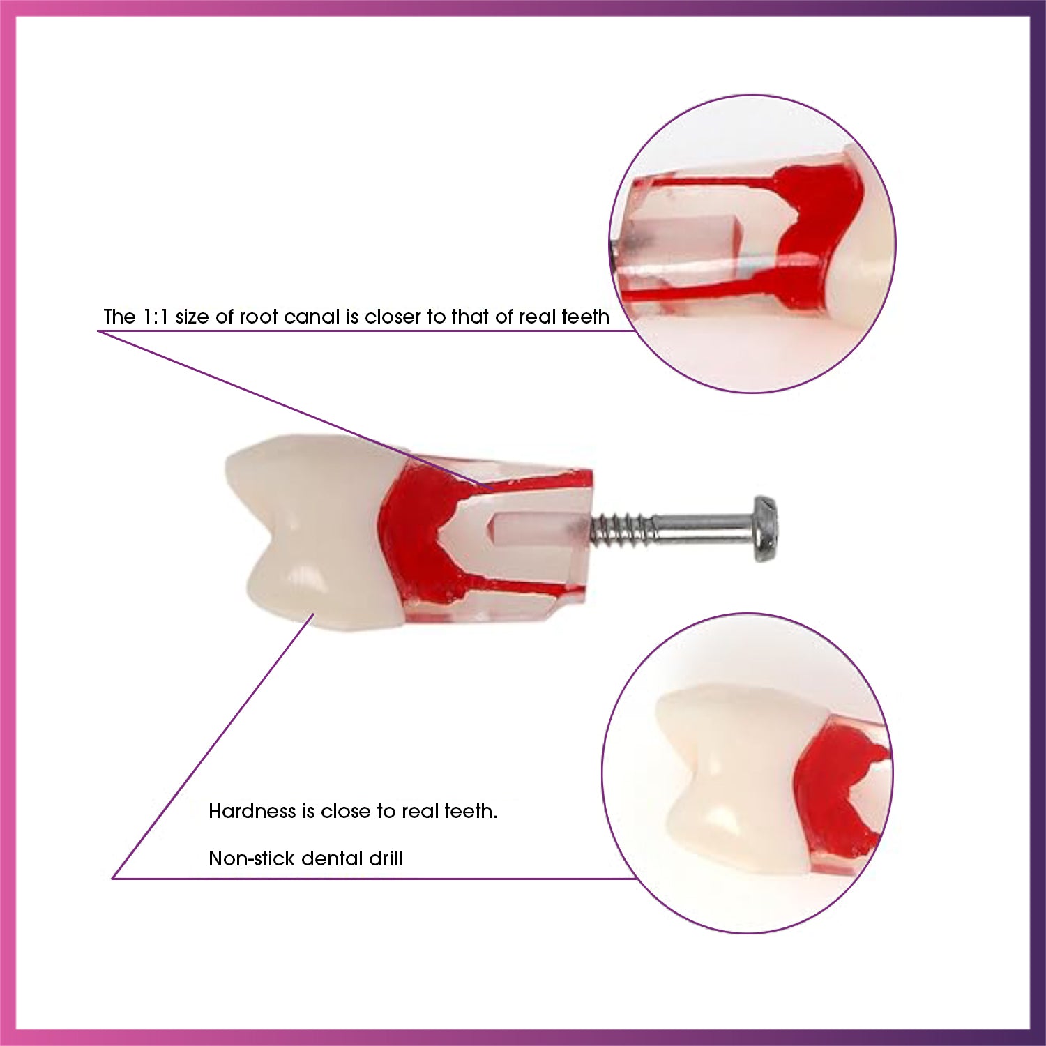 Kilgore Nissin Dental 200 Type 28 Dents RCT (Modèle de dents typodontes pour la pratique du traitement du canal radiculaire endoscopique)