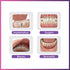 Ora-Aid - Attachable Intraoral Wound Dressing