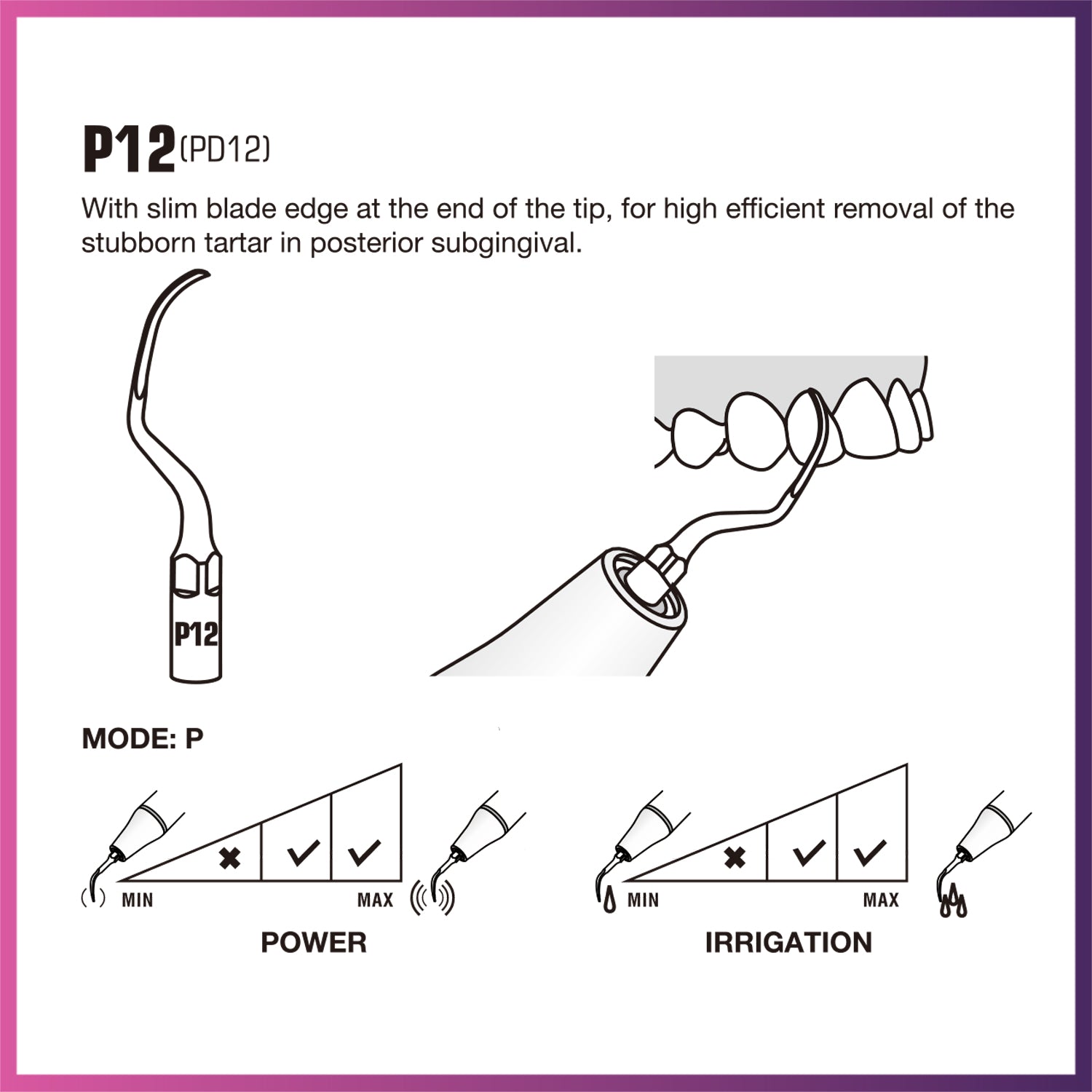 Woodpecker Ultrasonic Scaler Tip - P12