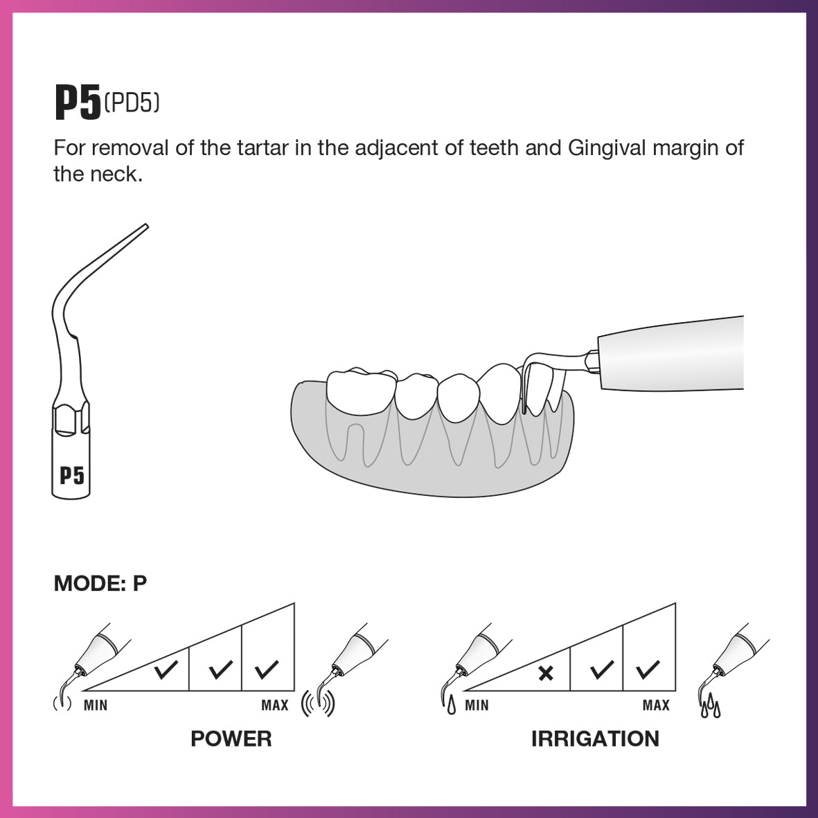 DTE Scaling Tip - PD5