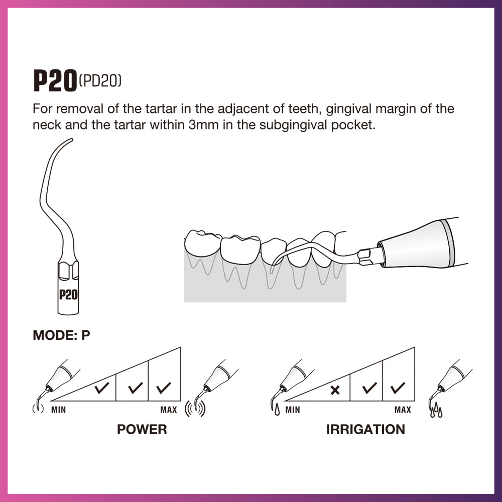 DTE Scaling Tip - PD20