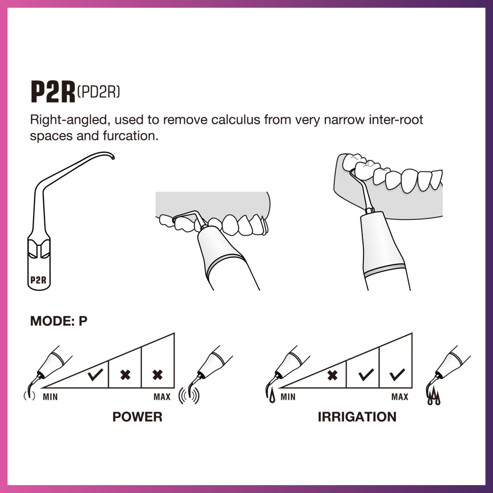 Punta periodontal Woodpecker/DTE - PD1 (paquete de 5)