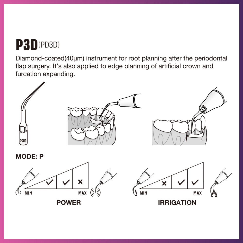 Punta periodontal Woodpecker/DTE - PD1 (paquete de 5)