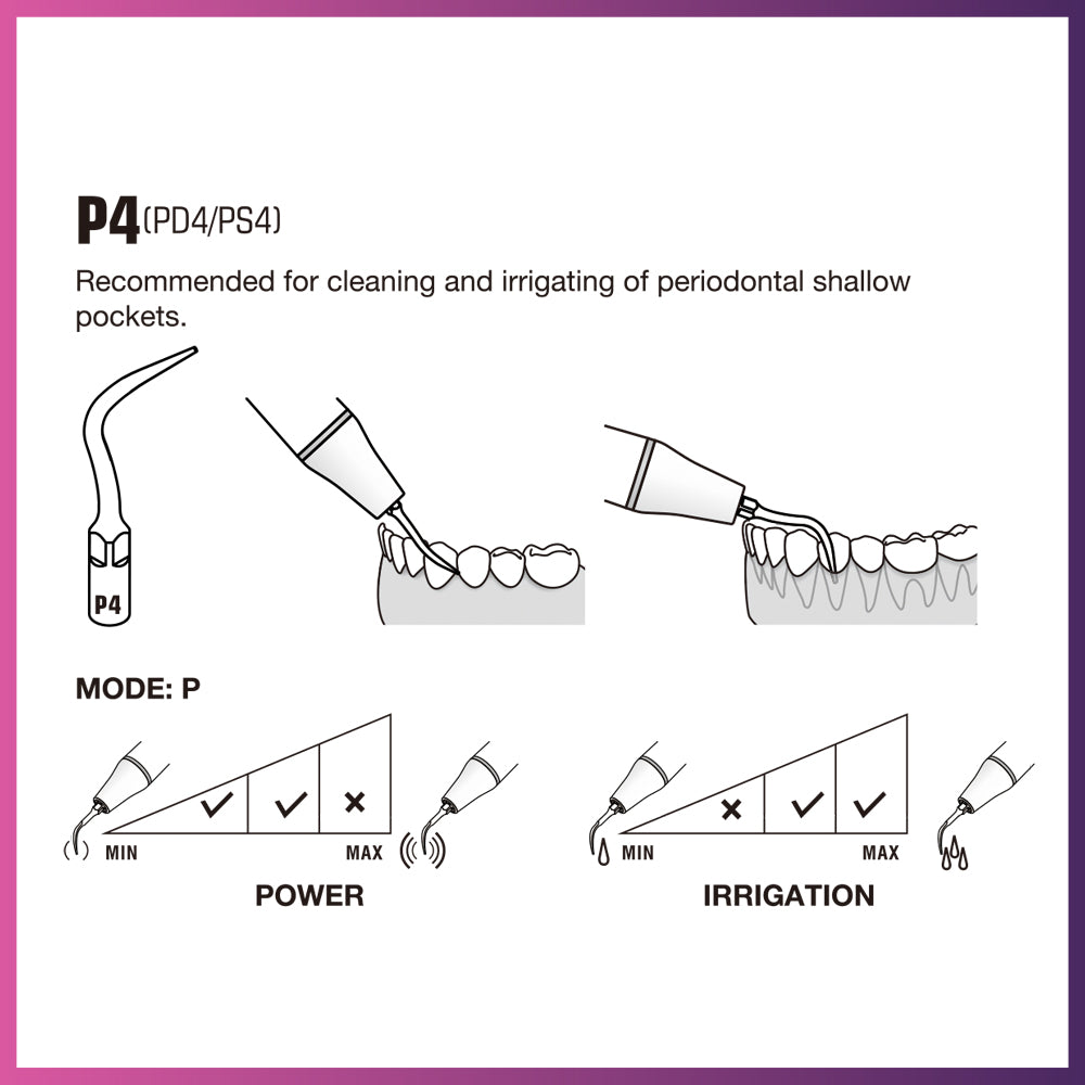 Punta periodontal Woodpecker/DTE - PD1 (paquete de 5)