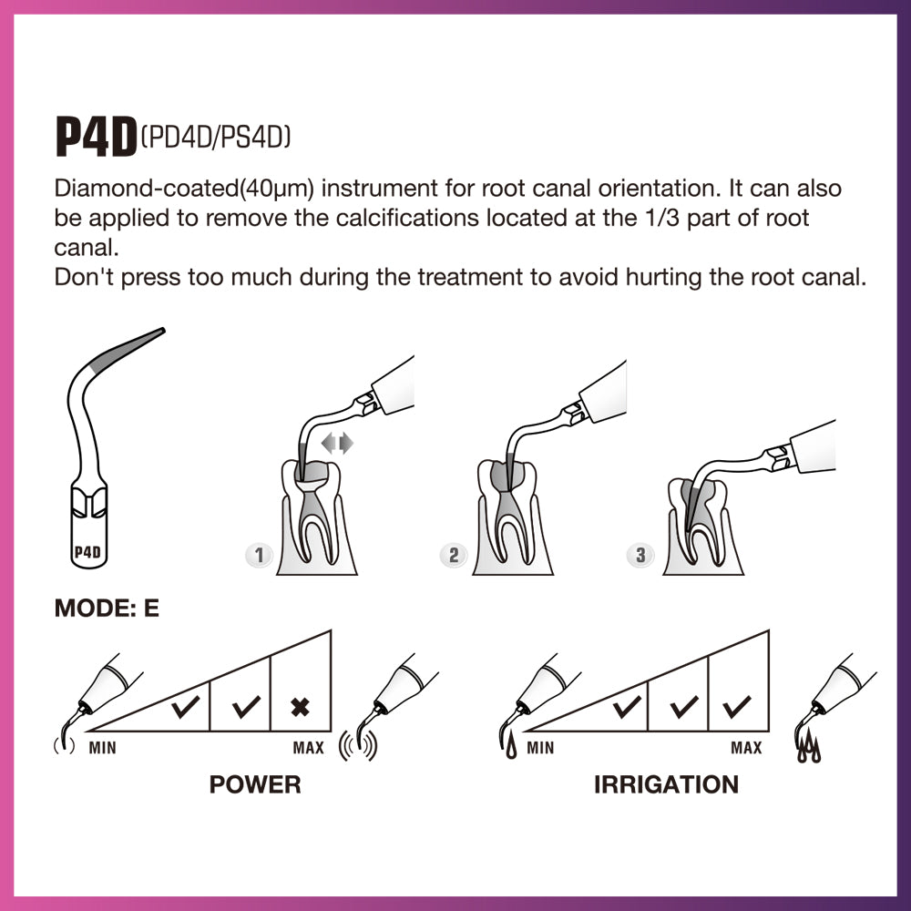 Punta periodontal Woodpecker/DTE - PD1 (paquete de 5)