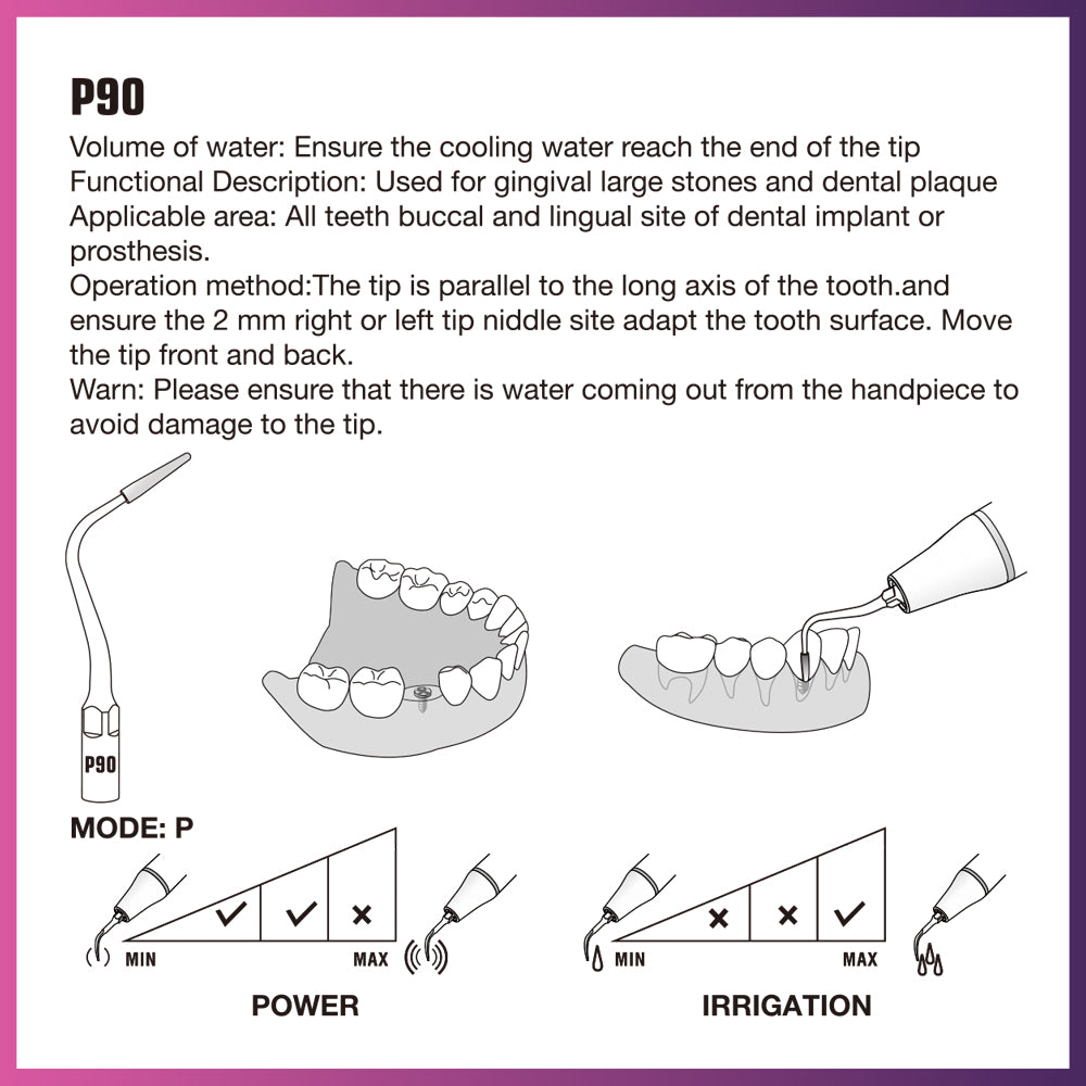 Punta periodontal Woodpecker/DTE - PD12