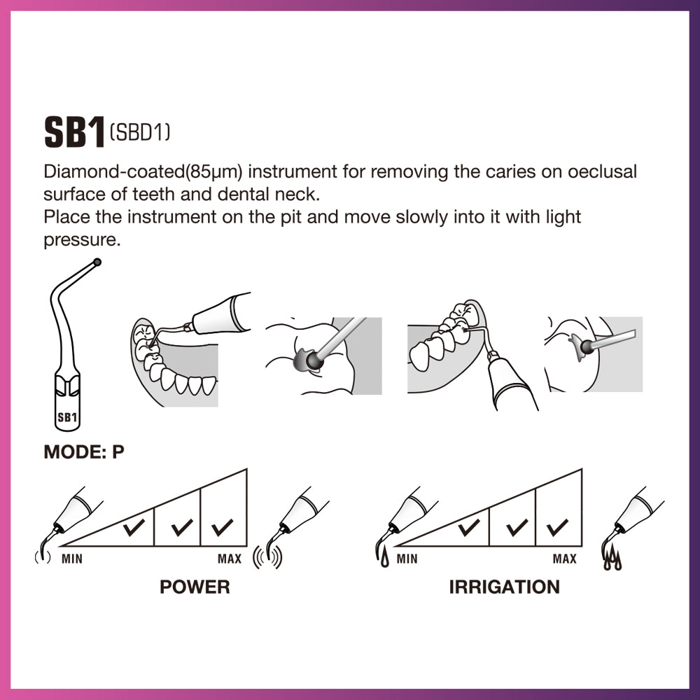 DTE Cavity Preparation Ultrasonic Tip - SBD1