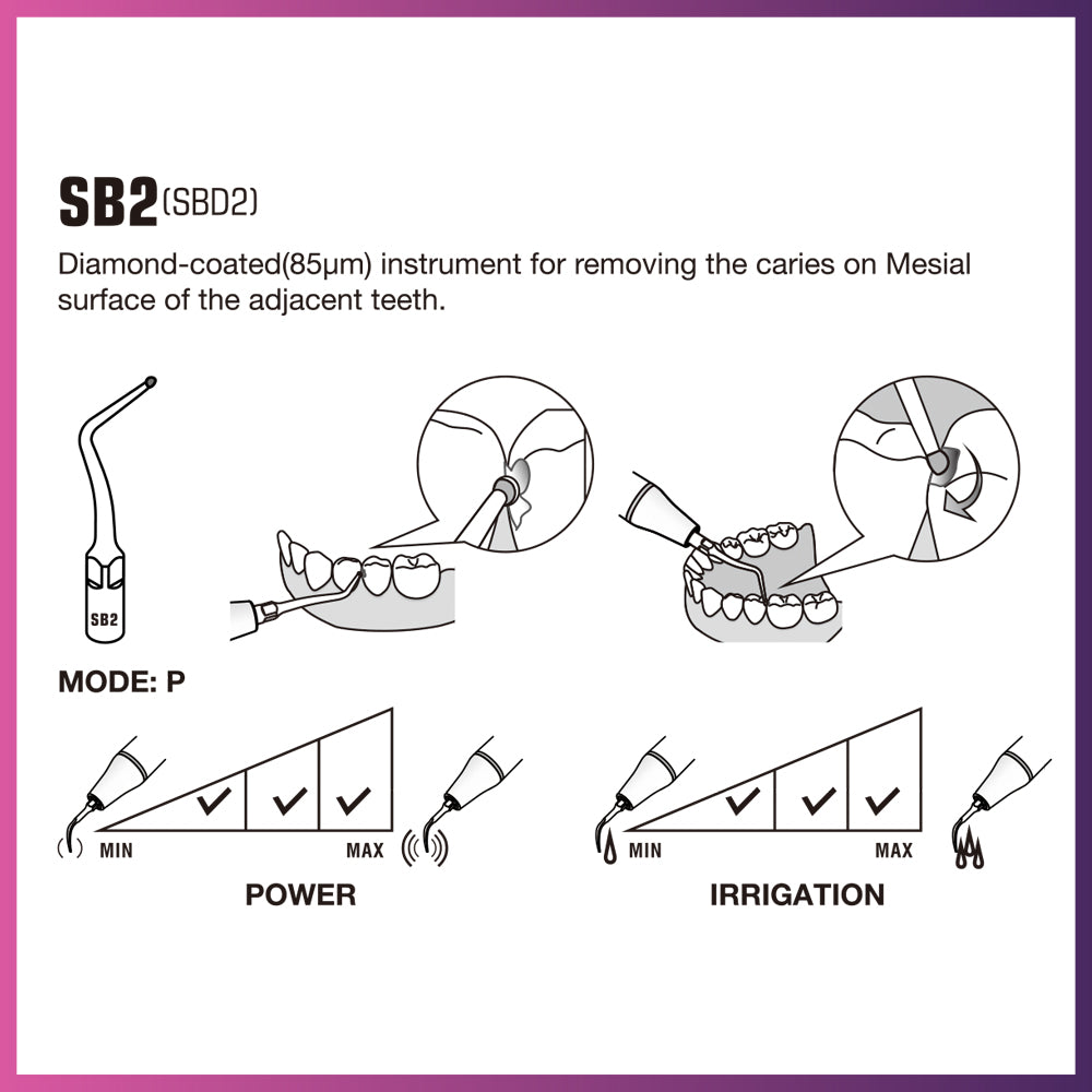 DTE Cavity Preparation Ultrasonic Tip - SBD2