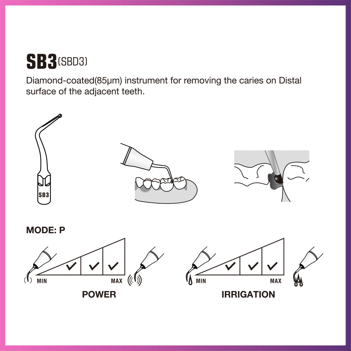 DTE Cavity Preparation Ultrasonic Tip - SBD3