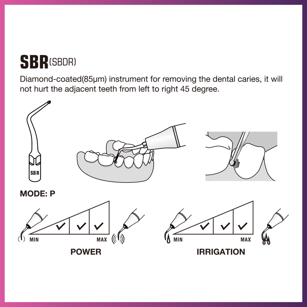 DTE Cavity Preparation Ultrasonic Tip - SBDR