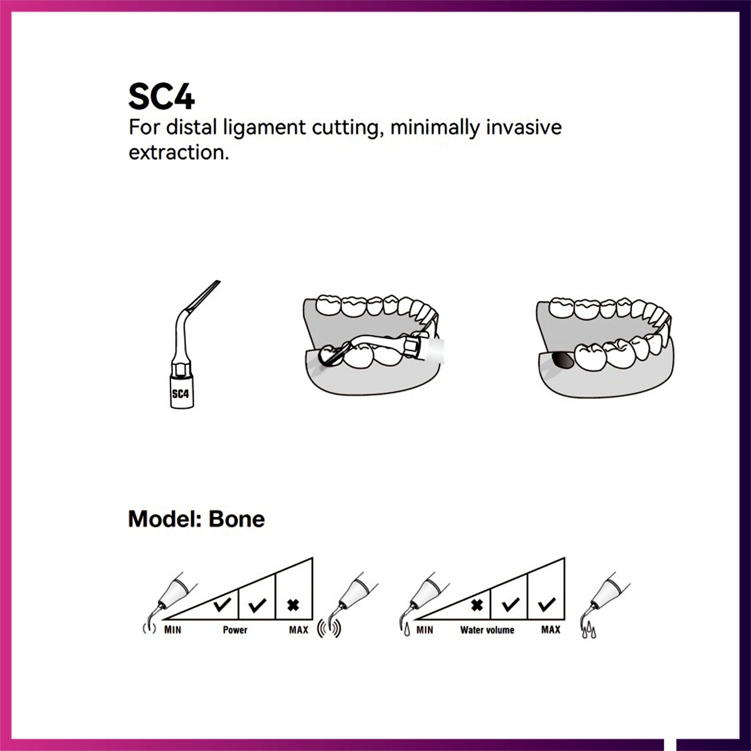 Woodpecker / DTE Surgery Tip - SC4