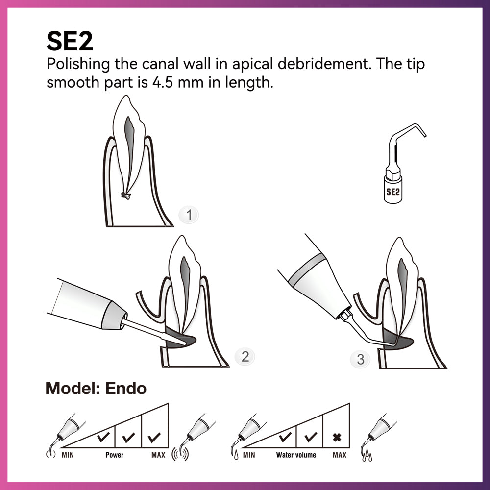 Conseils de chirurgie Woodpecker / DTE SE2