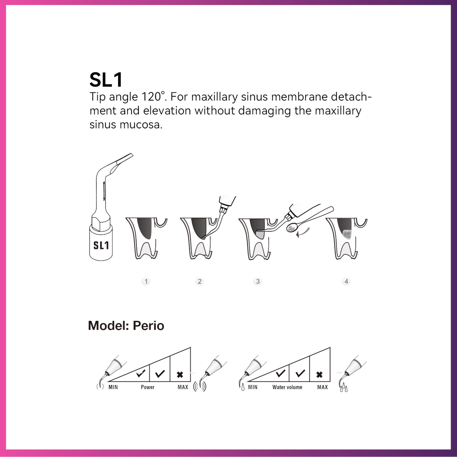 Pic-vert / Embout de chirurgie DTE - SL1