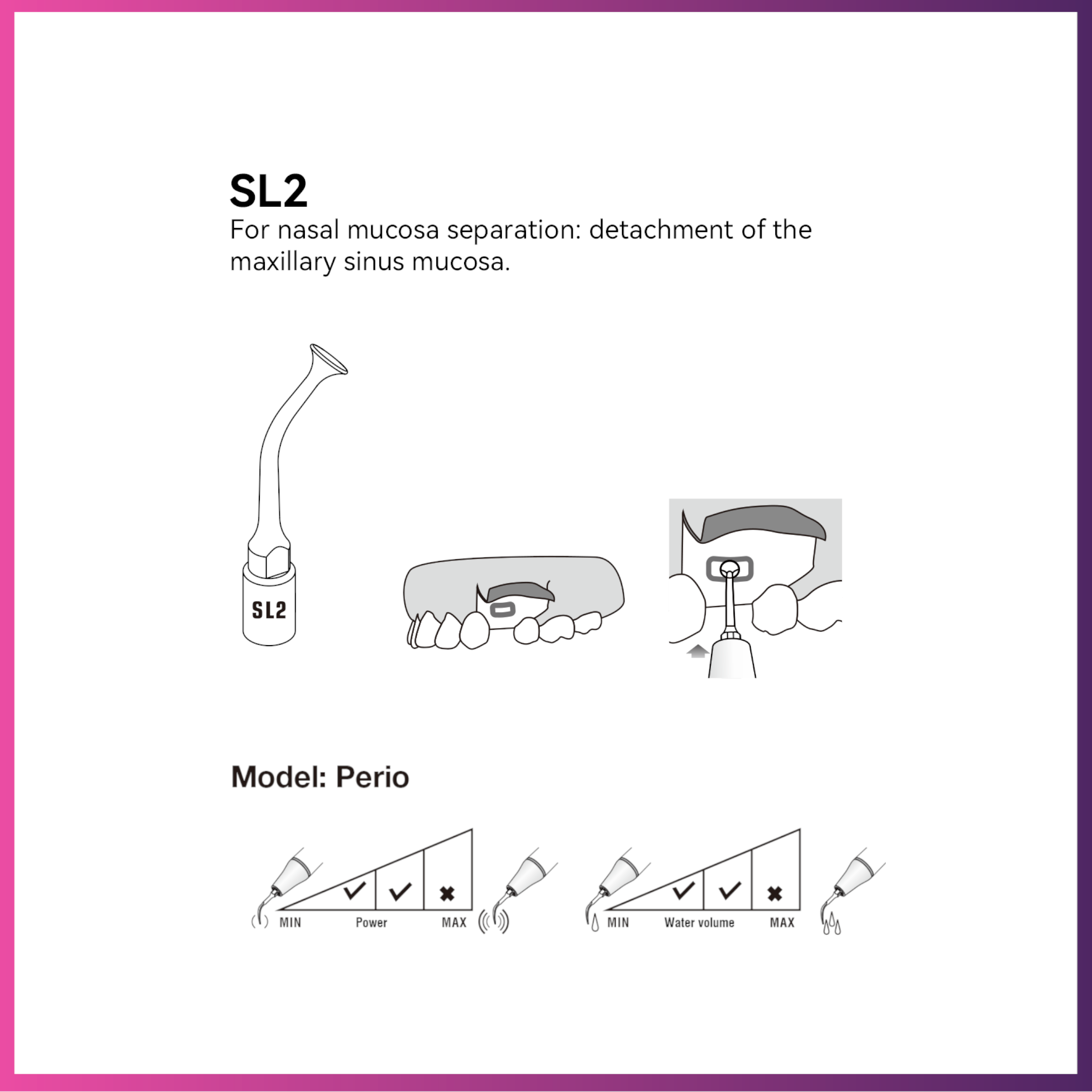 Pic-vert / Embout de chirurgie DTE - SL2