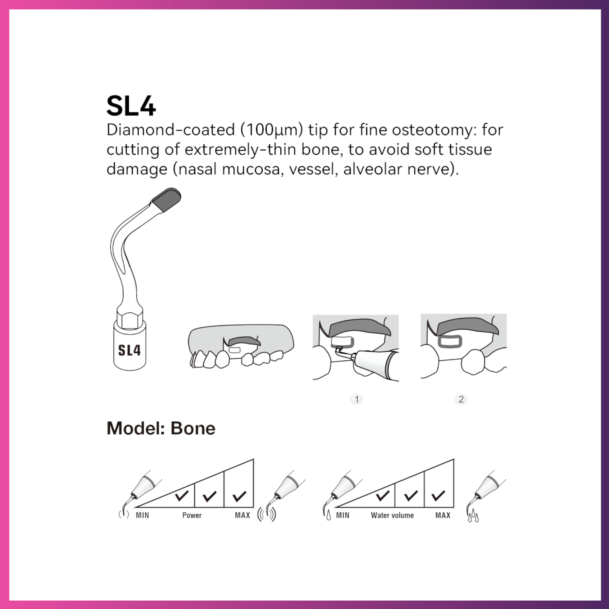 Woodpecker / DTE Surgery Tip - SL4