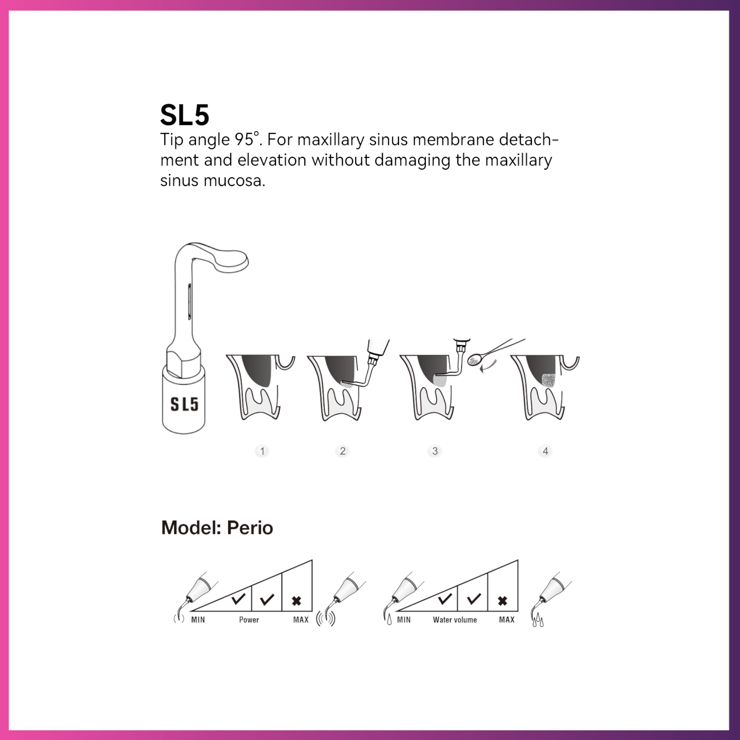 Woodpecker / DTE Surgery Tip - SL5