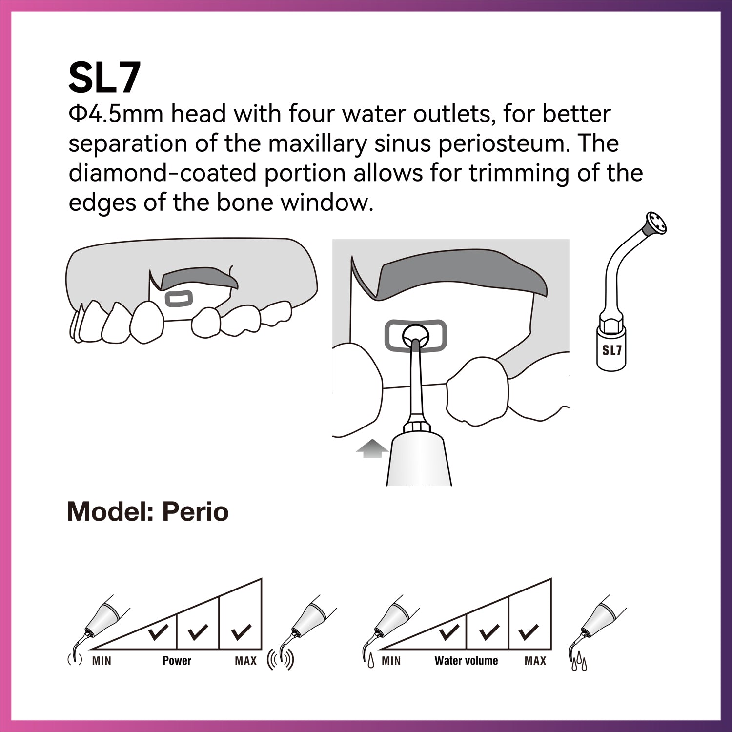 Woodpecker / DTE Surgery Tip - SL7