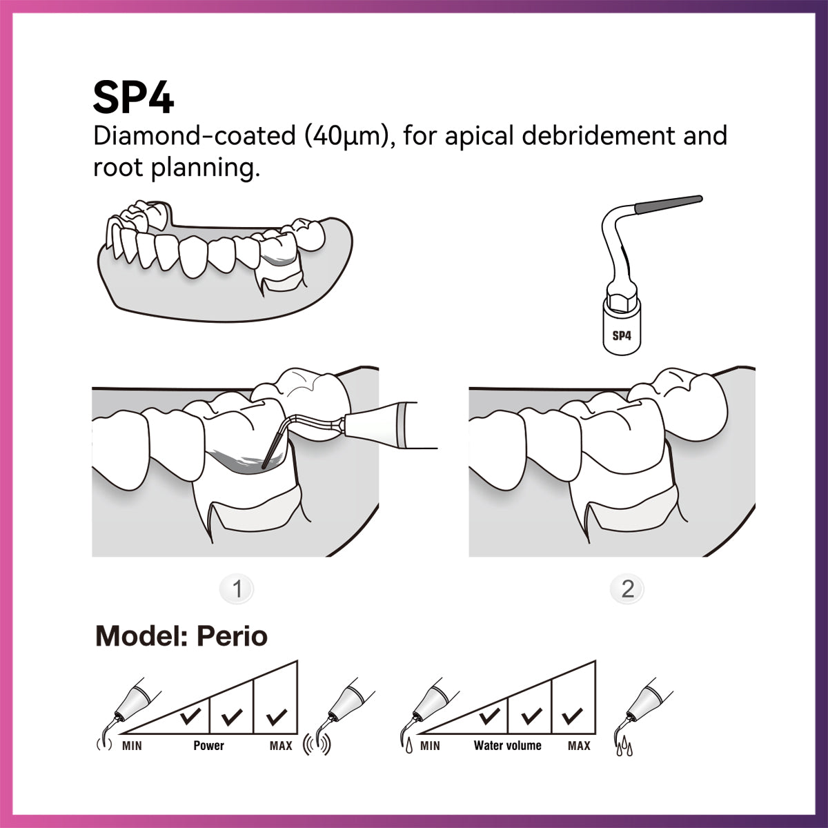 Woodpecker / DTE Surgery Tip - SP4