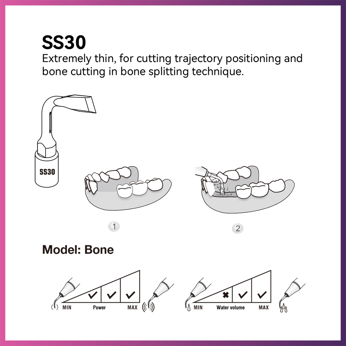 Woodpecker/ Ultra Surgery Tip - SS30