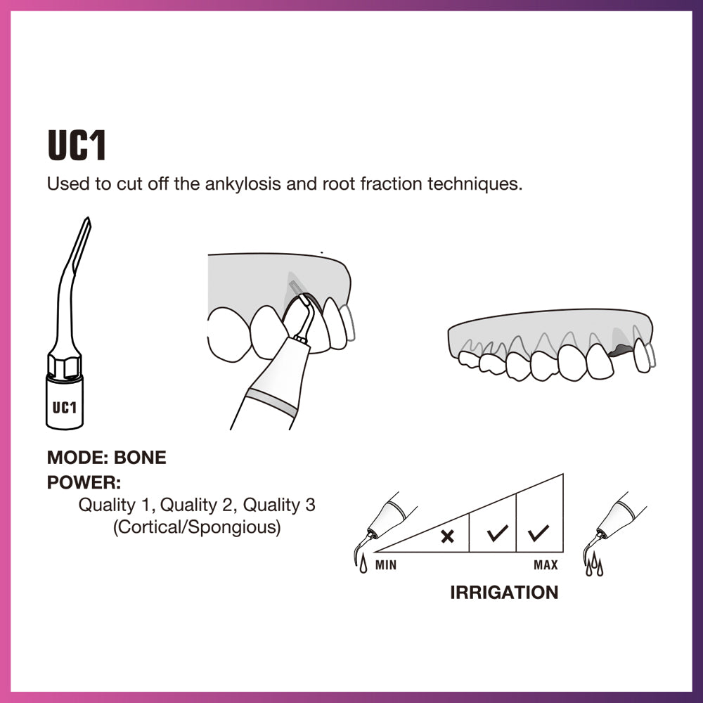 Woodpecker / Mectron Ultra Surgery Tip - UC1