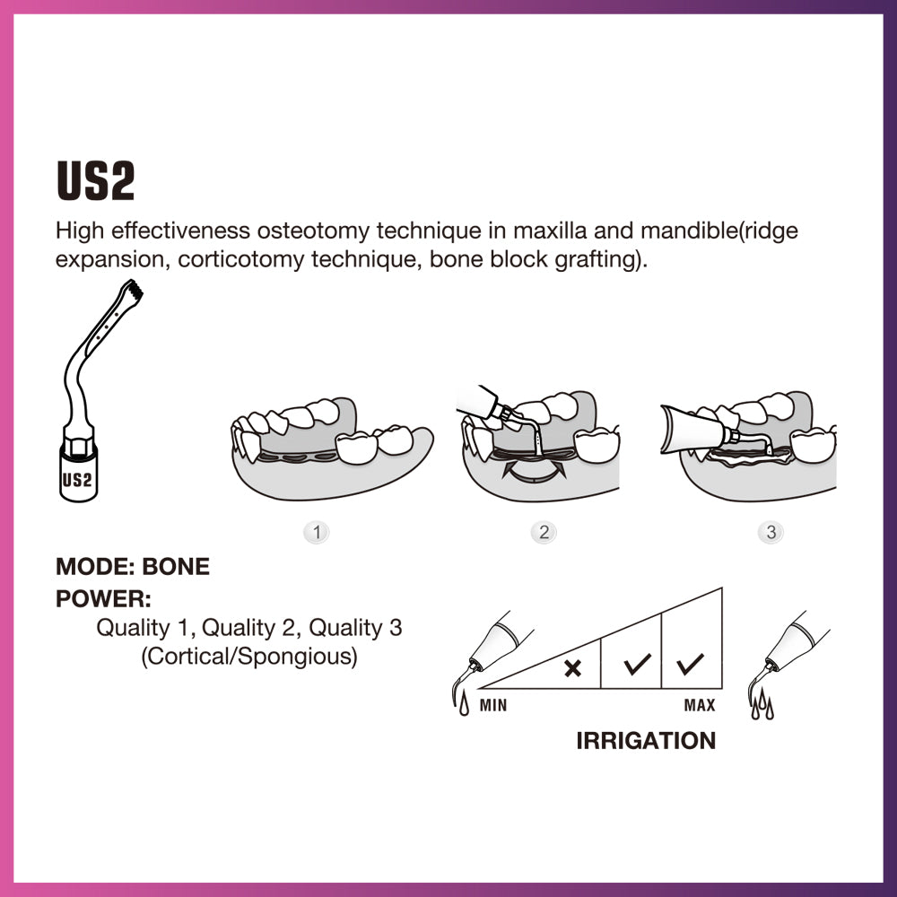 Woodpecker / Mectron  Ultra Surgery Tip - US2