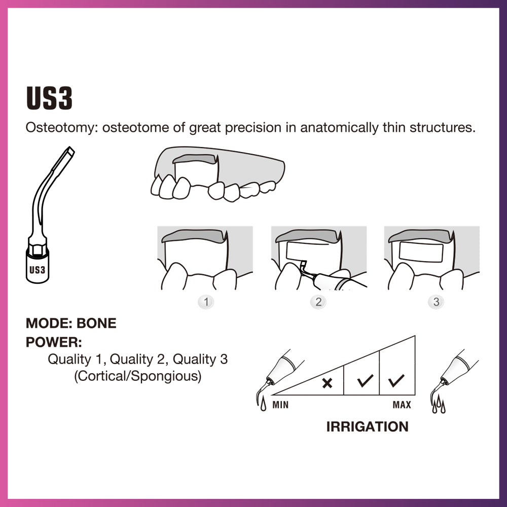 Woodpecker / Mectron Ultra Surgery Tip - US3