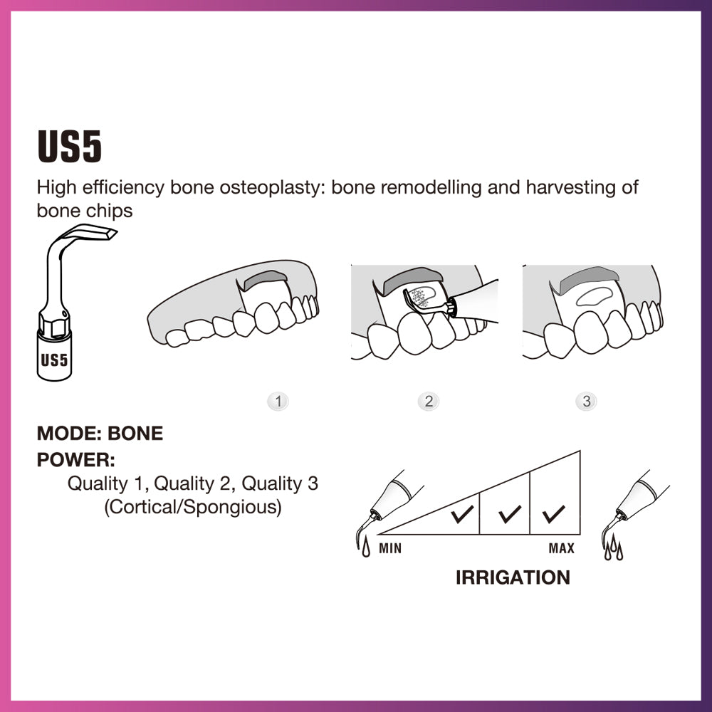 Woodpecker / Mectron Ultra Surgery Tip - US5